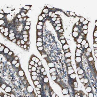 Immunohistochemistry-Paraffin: Urotensin-2 Antibody [NBP1-87223]