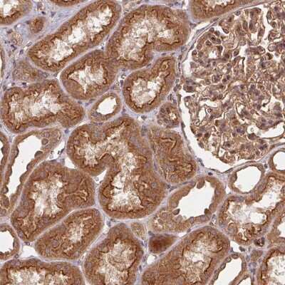 Immunohistochemistry: Use1/UBE2Z Antibody [NBP2-38568]