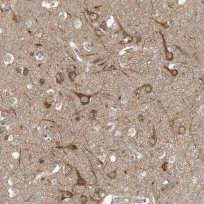 Immunohistochemistry-Paraffin: Use1/UBE2Z Antibody [NBP1-82785]