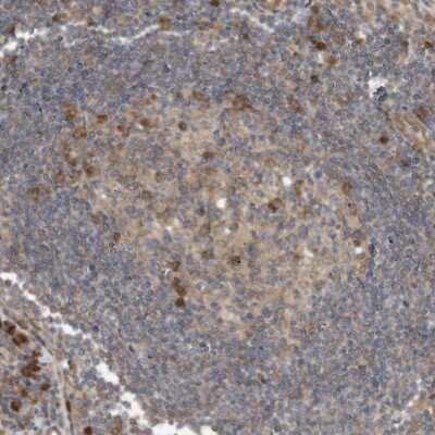 Immunohistochemistry-Paraffin: Use1/UBE2Z Antibody [NBP1-82785]