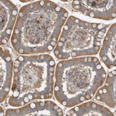 Immunohistochemistry-Paraffin: Use1/UBE2Z Antibody [NBP1-82785]