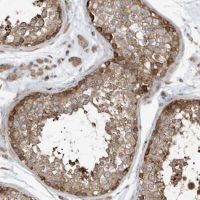 Immunohistochemistry-Paraffin: Use1/UBE2Z Antibody [NBP1-82785]