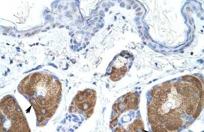 Immunohistochemistry-Paraffin: Use1/UBE2Z Antibody [NBP1-91539]