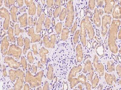 Immunohistochemistry-Paraffin: Use1/UBE2Z Antibody [NBP2-97553]