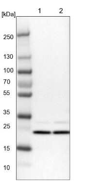 Western Blot: Use1/UBE2Z Antibody [NBP1-82785]