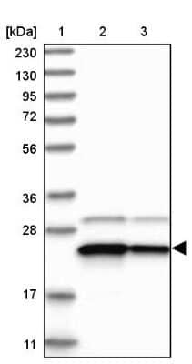 Western Blot: Use1/UBE2Z Antibody [NBP1-82785]