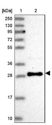 Western Blot: Use1/UBE2Z Antibody [NBP2-38568]