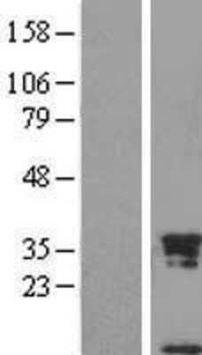 Western Blot: Uteroglobin/SCGB1A1 Overexpression Lysate [NBL1-15732]