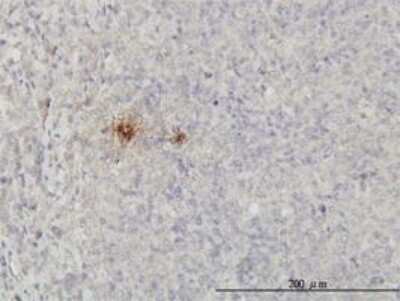 Immunohistochemistry-Paraffin: Uteroglobin/SCGB1A1 Antibody (4A5-A11) [H00007356-M01]