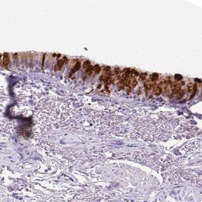 Immunohistochemistry-Paraffin: Uteroglobin/SCGB1A1 Antibody [NBP2-33961]