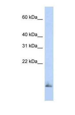 Western Blot: Uteroglobin/SCGB1A1 Antibody [NBP1-57961]