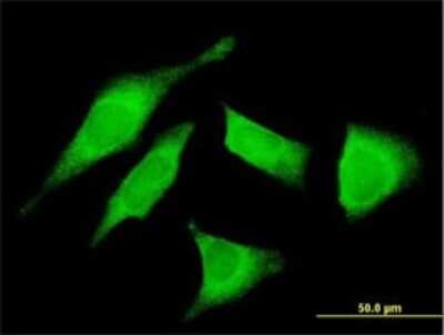 Immunocytochemistry/ Immunofluorescence: Utrophin Antibody (5G6) [H00007402-M01]