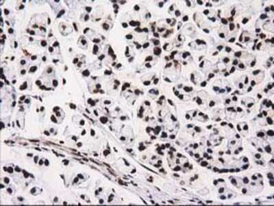 Immunohistochemistry-Paraffin: V-type proton ATPase subunit F Antibody (OTI1B8) [NBP2-03498]