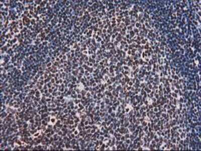 Immunohistochemistry-Paraffin: V-type proton ATPase subunit F Antibody (OTI1B8) [NBP2-03498]