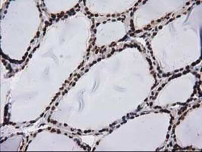 Immunohistochemistry-Paraffin: V-type proton ATPase subunit F Antibody (OTI1B8) [NBP2-03498]