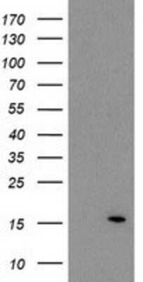 Western Blot: V-type proton ATPase subunit F Antibody (OTI1B8) [NBP2-03498]