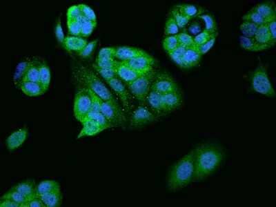 Immunocytochemistry/ Immunofluorescence: V-type proton ATPase subunit F Antibody [NBP2-97190]