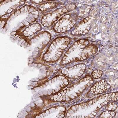 Immunohistochemistry: V-type proton ATPase subunit F Antibody [NBP2-38587]