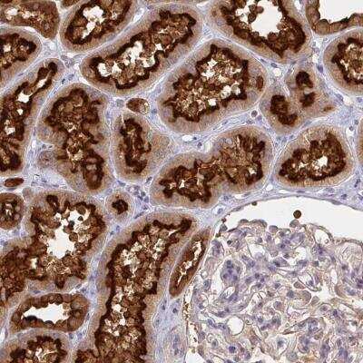 Immunohistochemistry-Paraffin: V-type proton ATPase subunit F Antibody [NBP2-38942]