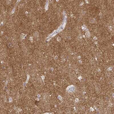 Immunohistochemistry-Paraffin: V-type proton ATPase subunit F Antibody [NBP2-38942]