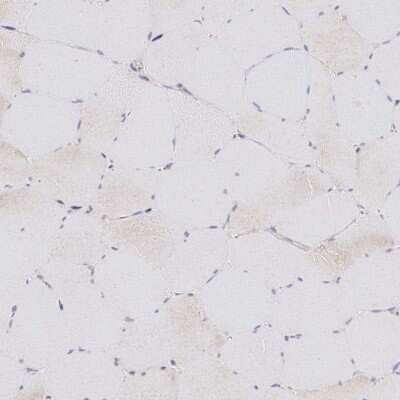 Immunohistochemistry-Paraffin: V-type proton ATPase subunit F Antibody [NBP2-38942]