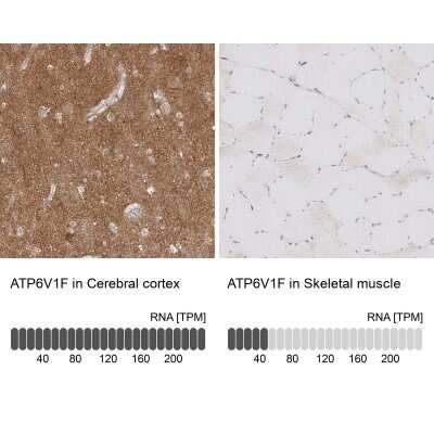 Immunohistochemistry-Paraffin: V-type proton ATPase subunit F Antibody [NBP2-38942]