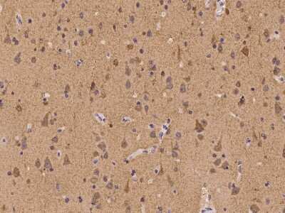 Immunohistochemistry-Paraffin: V-type proton ATPase subunit F Antibody [NBP2-97190]