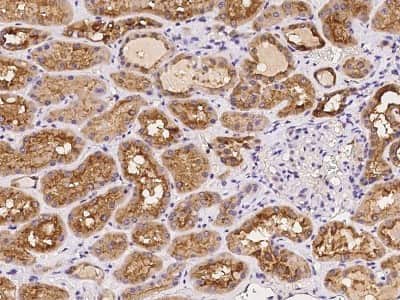Immunohistochemistry-Paraffin: V-type proton ATPase subunit F Antibody [NBP2-97190]