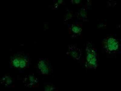 Immunocytochemistry/ Immunofluorescence: V-type proton ATPase subunit F Antibody (OTI1B8) - Azide and BSA Free [NBP2-74863]