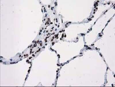 Immunohistochemistry: V-type proton ATPase subunit F Antibody (OTI1B8) - Azide and BSA Free [NBP2-74863]
