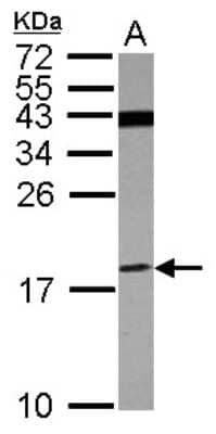 Western Blot: V-type proton ATPase subunit F Antibody [NBP2-15160]