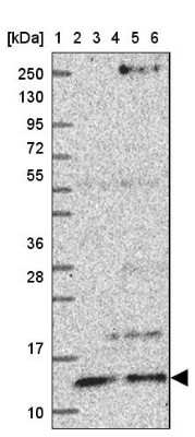 Western Blot: V-type proton ATPase subunit F Antibody [NBP2-38942]