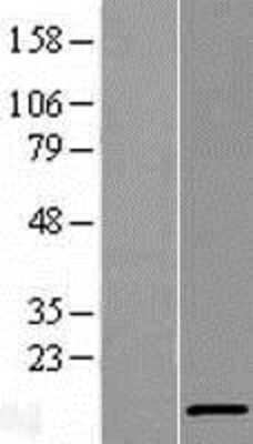 Western Blot: V-type proton ATPase subunit F Overexpression Lysate [NBL1-07845]