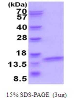 SDS-PAGE: Recombinant Human V-type proton ATPase subunit F His Protein [NBP2-51954]