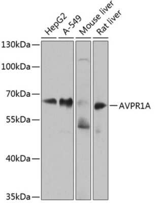 Western Blot: V1a Vasopressin R/AVPR1A AntibodyBSA Free [NBP2-94637]