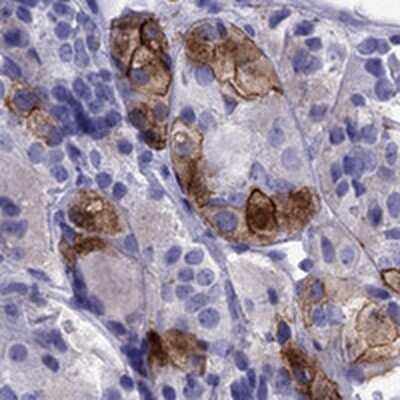 Immunohistochemistry: V1b Vasopressin R/AVPR1B Antibody [NBP2-69007]