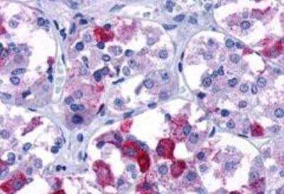 Immunohistochemistry-Paraffin: V1b Vasopressin R/AVPR1B Antibody - BSA Free [NLS266]