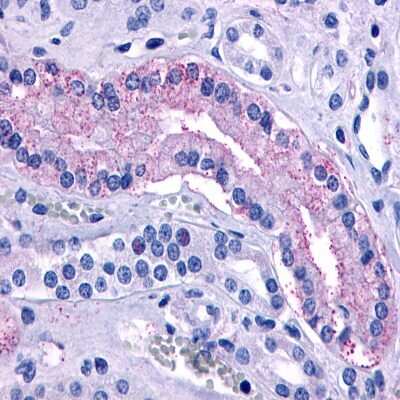 Immunohistochemistry-Paraffin: V2 Vasopressin R/AVPR2 Antibody - BSA Free [NLS272]