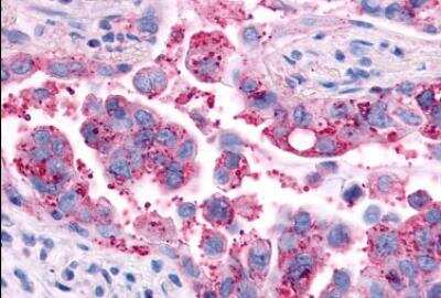 Immunohistochemistry-Paraffin: V2 Vasopressin R/AVPR2 Antibody - BSA Free [NLS272]