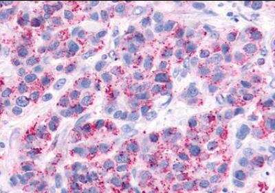 Immunohistochemistry-Paraffin: V2 Vasopressin R/AVPR2 Antibody - BSA Free [NLS272]