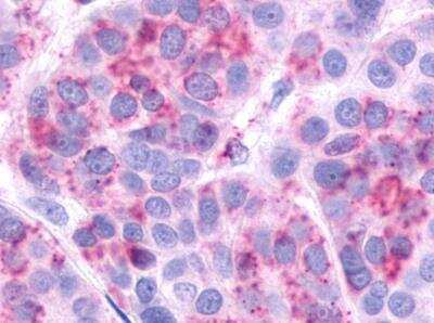 Immunohistochemistry-Paraffin: V2 Vasopressin R/AVPR2 Antibody - BSA Free [NLS272]