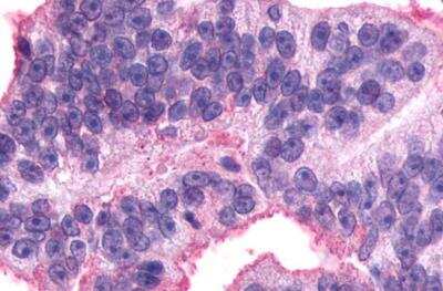 Immunohistochemistry-Paraffin: V2 Vasopressin R/AVPR2 Antibody - BSA Free [NLS272]