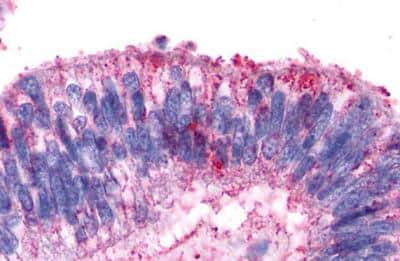 Immunohistochemistry-Paraffin: V2 Vasopressin R/AVPR2 Antibody - BSA Free [NLS272]