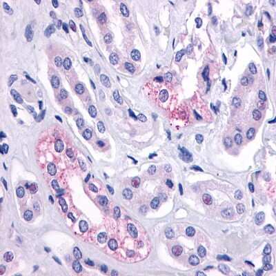Immunohistochemistry-Paraffin: V2 Vasopressin R/AVPR2 Antibody - BSA Free [NLS273]