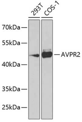 Western Blot: V2 Vasopressin R/AVPR2 AntibodyBSA Free [NBP2-93162]