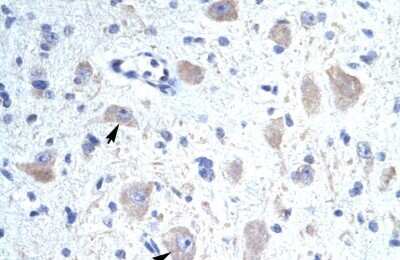 Immunohistochemistry: VABP Antibody [NBP2-88563]