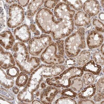 Immunohistochemistry-Paraffin: VABP Antibody [NBP1-81560]