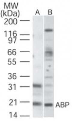 Western Blot: VABP Antibody [NBP2-19020]