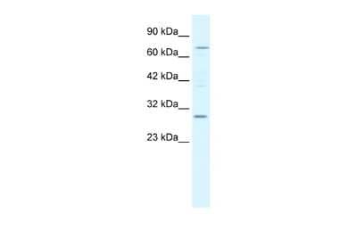 Western Blot: VABP Antibody [NBP2-88563]