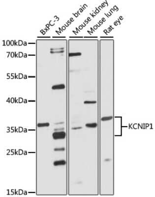 Western Blot: VABP AntibodyAzide and BSA Free [NBP2-93221]